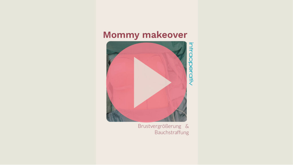 YouTube Video Platzhalter Mommy Makeover: Brustvergrößerung und Bauchstraffung im operativen Ablauf