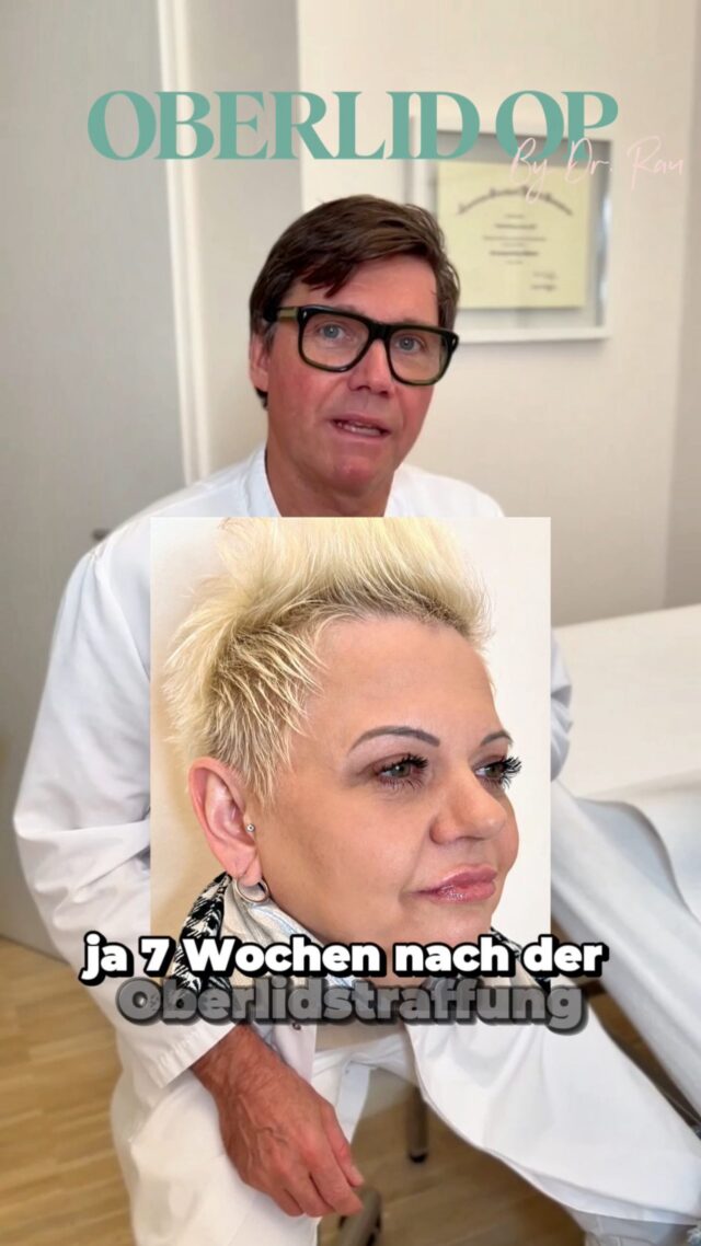 7 Wochen nach OBERLIDSTRAFFUNG 
- Patientenbericht ✨

Meine Patientin hat sich vor 7 Wochen für eine Oberlidstraffung durch mich entschieden. Sie teilt euch hier ihre Erfahrung mit. Was haltet ihr von dem Ergebnis? 

Herzliche Grüße, Euer Dr.Armin Rau 

#drarminrau #plastischerchirurg #schönheitschirurgie #hamburg #lidstraffung