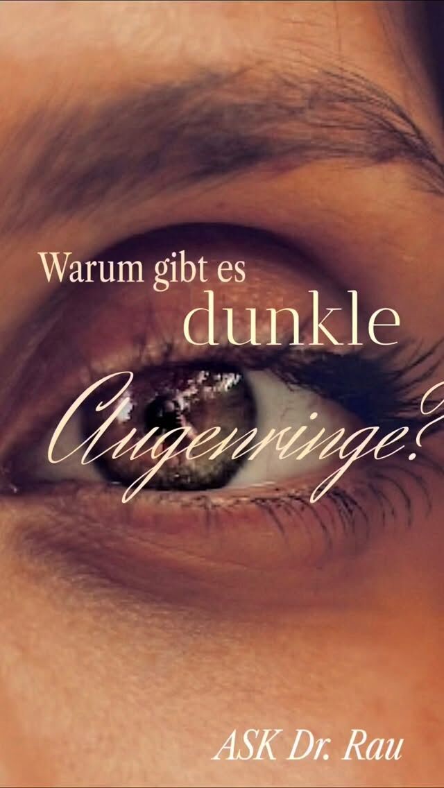 Warum entstehen Augenringe?

Augenringe sind häufig keine Frage von Müdigkeit, sondern der Anatomie des Unterlids.

Durch das Vorwölben der Fettkörper am Unterlid - den sogenannten Tränensäcken - und die gleichzeitige Konkarvtät der Tränenrinne entsteht ein charakteristisches Berg-Tal-Verhältnis.

Dieses verursacht ein ausgeprägtes Licht-Schatten-Spiel, das die Augenpartie dunkler und abgespannt erscheinen lässt.

Zusätzlich ist die Haut des Unterlids die dünnste Haut des menschlichen Körpers. Besonders im Bereich der Tränenrinne scheint dadurch der darunterliegende Ringmuskel (M. orbicularis oculi) dunkler durch, was den Eindruck von Augenringen weiter verstärkt.

Augenringe sind daher meist ein strukturelles Thema, also ein Zusammenspiel aus Volumen, Struktur sowie Licht und lassen sich gezielt behandeln, wenn die Ursachen korrekt analysiert werden.

Einen Termin für eine Beratung könnt Ihr über den online Terminkalender vereinbaren:

https://www.doctolib.de/einzelpraxis/hamburg/dr-armin-rau-plastische-chirurgie-hamburg/booking/motives?
specialityld=1297&telehealth=false& placeld=practice-364896&bookingFunnelSource-deep_link

oder telefonisch Mo-Fr 10-18h unter
040 4606 3344

Herzlichst, Euer Dr. Armin Rau

#müdeaugen #lidstraffung #oberlidstraffunghamburg #unterlidstraffung #drarminrau