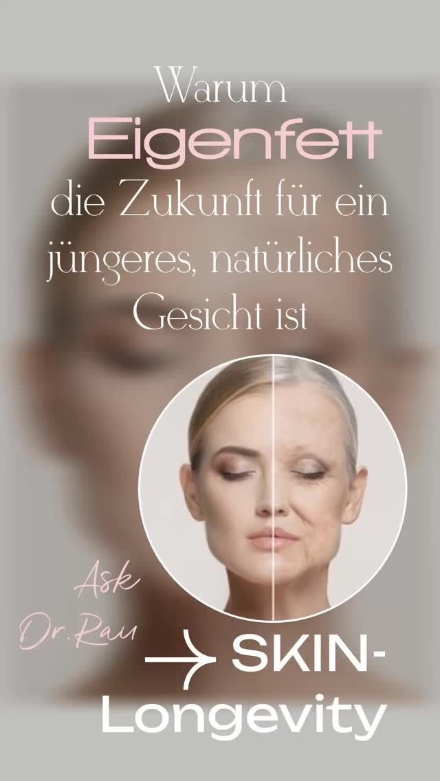Warum die Fetttransplantation das Geheimnis für ein jüngeres, weicheres Gesicht ist...

Was ist eine Fetttransplantation?
Bei einer Fetttransplantation wird Ihr eigenes, gereinigtes Fett verwendet, um die jugendliche Fülle wiederherzustellen, die Sie in Ihren 20ern und 30ern ganz natürlich hatten. Das Verfahren ist sanft, biokompatibel und passt sich Ihren eigenen Gesichtsausdrücken an.

Welche Bereiche profitieren am meisten?
- Tränensäcke
- Schläfen
- Wangen und Mittelgesicht
- Nasolabialfalten
- Stirn
- Augenbrauen 
- Marionettenfalten
- Kinn

Fetttransplantation im Vergleich zu Fillern:
Filler können kleine Fältchen mildern oder subtile Konturen schaffen, aber sie stellen nicht die weiche, natürliche Fülle der Jugend wieder her.

Wie lange hält das Ergebnis an?
Ein Teil des Fettes wird auf natürliche Weise resorbiert.
Der Rest wird Teil Ihres eigenen Gesichtsgewebes. Das bedeutet, dass die Ergebnisse viele Jahre anhalten können und oft viel länger als bei Fillern.

Wer ist der beste Kandidat? Eine Fetttransplantation könnte das Richtige für Sie sein, wenn...
- Ihr Gesicht müde und eingefallen wirkt
- Sie sich eine natürlichere Verjüngung wünschen
- Sie eine länger anhaltende Lösung wünschen
- Sie Volumen ohne synthetische Materialien wünschen
- Sie jung sind, aber zu viel Volumen verloren haben (durch GLP-1) 

  Eine Fetttransplantation „fügt nicht nur Volumen hinzu“. Sie verjüngt das Gesicht auf eine Weise, wie es Filler allein nicht können.

In dieser Bildergalerie sehen Sie, wie eine Fetttransplantation die Wangen, die Augenpartie, die Schläfen, die Stirn und mehr auffrischen kann – sogar jene Bereiche, die mit Fillern oft nur schwer zu verbessern sind.

Habt ihr Fragen zum Thema Lipofilling? 
www.dr-armin-rau.de 
 
Euer Dr. Armin Rau 

#drarminrau #lidstraffung #plastischechirurgiehamburg #eigenfett