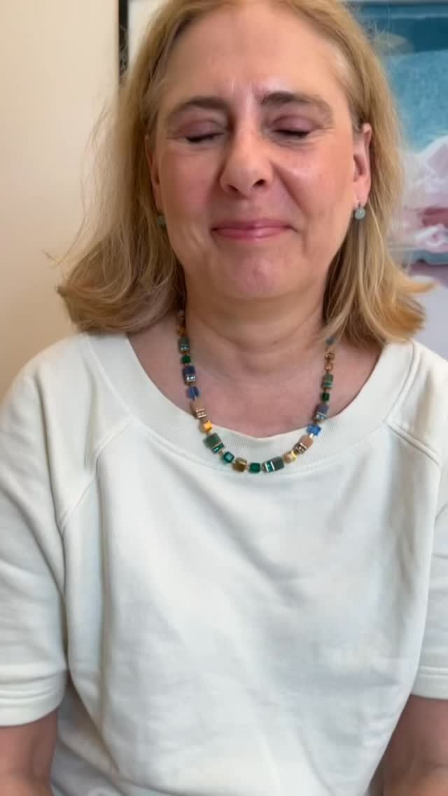 Individualisierte & personalisierte Oberlidstraffung - upper eyelid lift custom made

So einzigartig wie meine Patienten sind, ist auch ihr jeweiliger Befund.

Die Kunst für ein perfektes Ergebnis bei einer Oberlidstraffung beginnt bei der Planung. Diese muss im Sitzen erfolgen, damit meine Patienten nach der Operation die Augen noch vollständig schließen können, aber im geschlossenen Zustand kein Hautüberschuss mehr besteht.

Ich lege zudem großen Wert auf eine optimale Blutstillung. Dadurch haben meine Patienten meist kein Hämatom - es entstehen keine Pandabär-Augen.

Wegen meiner nahezu 33-jährigen chirurgischen Erfahrung und über 30.000 Operationen besteht besonders im Bereich der Lidstraffungen eine besondere Sicherheit.

Je länger eine Wunde „offen“ ist, umsomehr Entzündungsmediatoren werden freigesetzt. Durch die kurze Op-Zeit von etwa 20 Minuten entsteht anschließend meist auch eine lediglich geringe Schwellung.

Meine Patienten berichten überwiegend, dass sie keinerlei Schmerzen verspürt haben - weder im Rahmen der Operation, noch danach.

Die Oberlidstraffung verbindet sowohl ästhetische wie auch funktionelle Aspekte. Funktional führt der Hautüberschuss zu einem eingeschränkten Gesichtsfeld und Druck auf die Liddeckel. 

Letzteres führt häufig zu einem unbewussten Hochziehen der Augenbrauen, um die Liddeckel zu entlasten. Dies hat nicht selten Kopfschmerzen zur Folge und begünstigt die Entstehung tiefer Stirnfalten.

Kosmetisch wird durch die Oberlidstraffung die nach außen ansteigende Augenachse wird wieder sichtbar und der Blick dadurch wacher. Zudem entspannt sich die Stirn auch wieder. Stirnfalten reduzieren sich.

Für eine persönliche Beratung könnt Ihr gerne einen Termin über den online Terminkalender vereinbaren oder telefonisch Mo-Fr 10-18h unter 040 4606 3344

Herzlichst, Euer Dr. Armin Rau

#schönheitschirurgie #oberlidstraffung #plastischechirurgiehamburg #drarminrau #hamburg