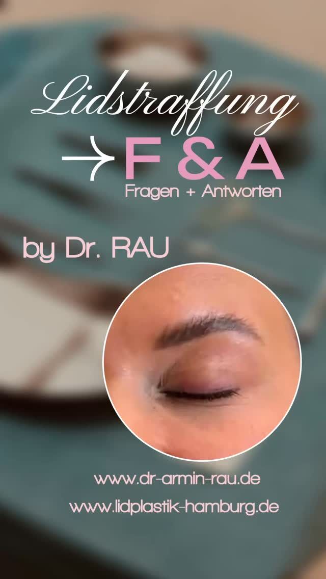 Frischer Blick in kurzer Zeit - Oberlidplastik by Dr. Armin Rau in Hamburg

Müde Augen, Schlupflider oder ein „schwerer Blick“? Die Oberlidstraffung (Oberlidplastik) kann zu einem wachen, verjüngten Aussehen verhelfen - und das besonders schonend und sicher durch Dr. Armin Rau in Hamburg.

Warum Dr. Rau?
Mit jahrelanger Erfahrung in der ästhetischen und rekonstruktiven Chirurgie arbeitet Dr. Rau mit einer besonders präzisen, gewebeschonenden Technik, die nicht nur natürliche Ergebnisse liefert, sondern auch die Heilungszeit deutlich verkürzt.

Schonend & sicher:
Dank moderner Verfahren und feiner Schnittführung verläuft die OP nahezu schmerzfrei, mit minimalem Risiko und kaum sichtbaren Narben.

Kurze Ausfallzeit:
Bereits nach wenigen Tagen ist man wieder gesellschaftsfähig - ganz ohne lange Ausfallzeit.

Vereinbaren Sie jetzt ein Beratungsgespräch und erfahren Sie, wie unkompliziert Ihr Weg zu einem offenen, frischen Blick sein kann

über den online Terminkalender

https://www.doctolib.de/einzelpraxis/hamburg/dr-armin-rau-plastische-chirurgie-hamburg/booking/motives?specialityId=1297&telehealth=false&placeld=practice-364896&bookingFunnelSource=deep_link

oder telefonisch Mo-Fr 10-18h unter

040 4606 3344
Euer Dr. Armin Rau 

#drarminrau #lidstraffung #hamburg #oberlidstraffung #facelift