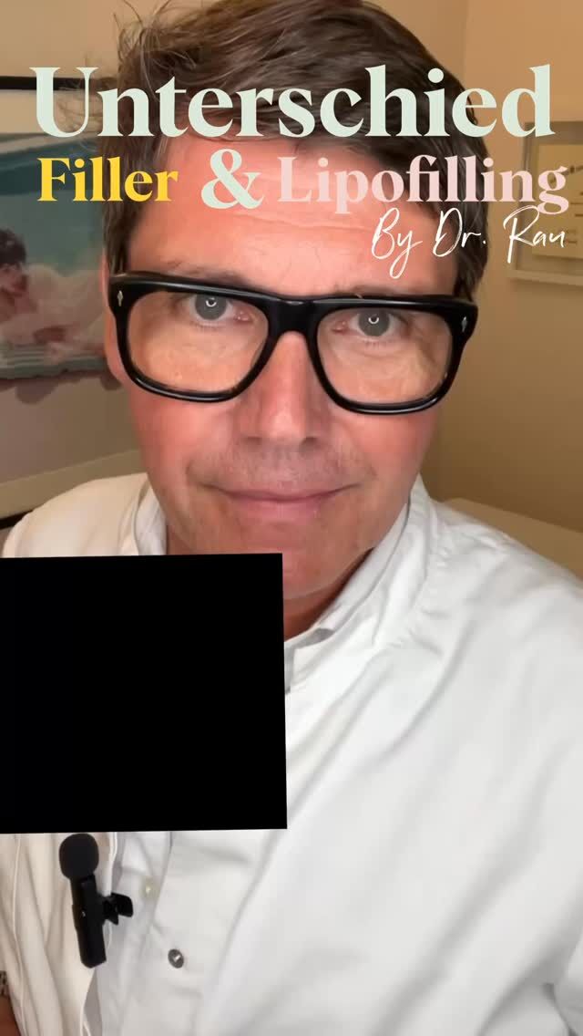 Reverse Aging – Warum Eigenfett mehr kann als synthetische Filler
Hyaluronsäure, Radiesse® und Sculptra® können Volumen ersetzen oder die Kollagenbildung anregen. Ihre Wirkung ist jedoch zeitlich begrenzt: Hyaluronsäure hält meist 6–12 Monate, Radiesse® bis zu 18 Monate und Sculptra® bis zu 24 Monate. Nur Hyaluronsäure ist für den Lippenaufbau zugelassen und kann im Bedarfsfall mit Hyaluronidase behandelt werden – Radiesse® und Sculptra® hingegen sind nicht auflösbar.
Eigenfett verfolgt einen anderen Ansatz: Als körpereigenes Gewebe fügt es sich natürlich in das Gesicht ein und enthält regenerative Zellen, die die Hautqualität und Geweberegeneration unterstützen können. Das dauerhaft eingeheilte Fett kann über viele Jahre erhalten bleiben und altert gemeinsam mit dem Gesicht – für ein natürliches und langfristiges Ergebnis.
#ReverseAging #Eigenfett #Lipotransfer #RegenerativeMedizin #Gesichtsverjüngung NatürlicheSchönheit Hyaluronsäure Radiesse Sculptra PlasticSurgery