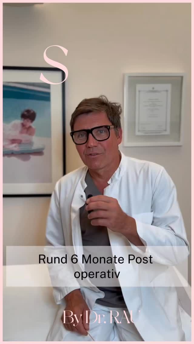 Warum entscheiden sich so viele Patienten für eine Oberlidstraffung by Dr. Armin Rau?

Patienten schätzen insbesondere:
��die präzise Planung zur Vermeidung eines unvollständigen Lidschlusses
��die atraumatische Operationstechnik
��die meist sehr kurze Ausfallzeit
��die äußerst sorgfältige Blutstillung mit geringem Risiko für Blutergüsse
��die schnelle Rückkehr in Alltag, Beruf und Sport
��natürlich wirkende Ergebnisse ohne „operierten“ Eindruck
Dauer der Heilung nach einer Oberlidstraffung by Dr. Armin Rau

Gesellschaftsfähig nach wenigen Tagen
Schnelle Rekonvaleszenz durch atraumatische Op-Technik
Meist nicht einmal eine Woche lang Einschränkung

Wann kann man nach einer Oberlidstraffung wieder arbeiten?

Patienten arbeiten nach 3 Tagen am PC (2. B. Freitag Op, Montag PC

Warum selten Blutergüsse nach Oberlidstraffung by Dr. Armin Rau?

Dank sorgfaltigster Blutstillung entstehen meist keine Hämatome
Dies trägt zur schnellen Heilung bei.

Warum entstehen Schwellungen unter den Augen?

Nach 2 Tagen tritt leichte Schwellung an Unterlidem auf,
da durch die Schwerkraft Gewebeflüssigkeit nach unten absackt
Meist ist die Schwellung zum Fadenzug nach 1 Woche weitgehend abgeklungen.

Wie wird ein inkompletter Lidschluss nach einer Oberlidstraffung vermieden?

Die spezielle Planung lässt die individuell zu entfernende Hautmenge exakt bestimmen.
Dadurch kann ein unvollständiger Lidschluss (Lagophthalmus) vermieden werden.

Ist eine Oberlidstraffung schmerzhaft?

Patienten berichten von nur geringen bis keinen Beschwerden nach dem Eingriff
Viele hätten die Operation viel früher durchführen lassen, wenn sie den unkomplizierten Ablauf gekannt hätten.
About Dr. Armin Rau

Dr. Armin Rau gilt als der Spezialist für Lidstraffungen in Hamburg
Sein Behandlungskonzept kombiniert eine
- präzise Planung mit einer
gewebeschonenden Operationstechnik für
natürliche Ergebnisse und eine schnelle Heilung.

www.dr-armin-rau.de
Euer Dr. Armin Rau 

#lidstraffung #oberlidstraffung #schönheitschirurgie #plastischerchirurg #drarminrau